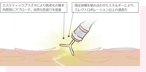 エステティックプラズマにより肌老化の根本的原因にアプローチ。自然な若返りを促進 高圧放電を組み合わせたエネルギーにより、エレクトロポレーション以上の浸透力